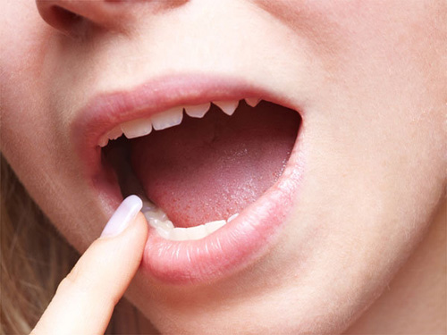 Cấu tạo của lưỡi là gì? Chức năng của lưỡi là gì? Tìm hiểu chi tiết
